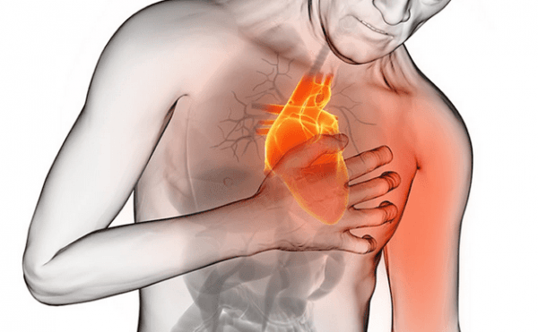 maladie cardio-vasculaire